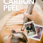 carbonpeel