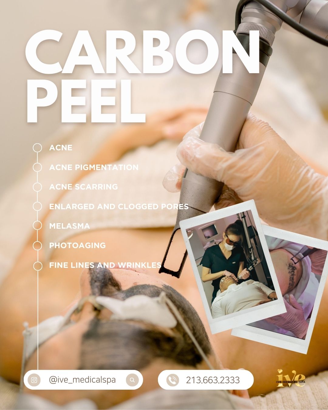 carbonpeel