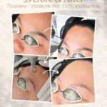 eyebrow pmu tatto removal BEFORE & AFTER