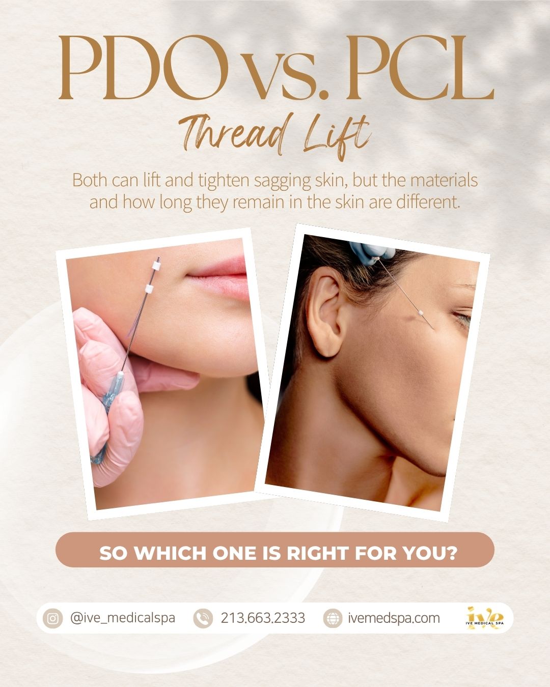 PDO vs. PCL Thread Lift